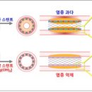 다다개발 네이버블로그