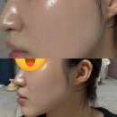 튠에디션 | 내돈내산)메디큐브 헬로키티에디션 부스터프로 후기