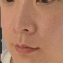 순에스테틱 피부미용 | | 해운대피부관리 | 여은에스테틱 1:1 맞춤 실버디톡스 만족 후기