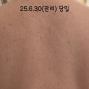 뉴대구사우나 | 대구 수성구 뉴알라딘 로즈 등필링 후기 피어나뷰티 추천