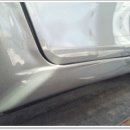 덴트렉스 이미지