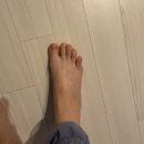 불광역2번출구 뒤 (정승기 정형외과) | ［일상］새끼발가락 골절 후기 1편