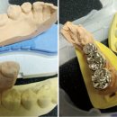 아트치과기공소 이미지