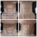 안지혜 뷰티 | [공지] 홈시술/에스테틱/효과를보는 코챌라화장품/찐후기/리얼후기/정말이게 가능할까?진짜일까?