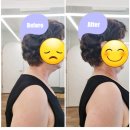 (주)리샘 | 진짜 교정센터 리샘필라테스 70대 여성 회원님 거북목 굽은등 비포 애프터 변화 후기