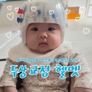 지오전자 | 사두증 단두증 두상교정 지오헬멧 광교점 후기 (내돈내산)