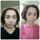 동안만들기ㅡ친구보다 10살 어려지기 참~쉬워요~♡