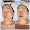 제주 아우룸 | 제주 피부관리 리프팅 후기 크레이지015 “루미네아우룸”