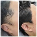 블랭크smp 이미지