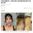 “의사도 몰랐다?”… 피로·속쓰림 느끼던 32세 여성, 결국 ‘이 암’ 말기 진단 이미지