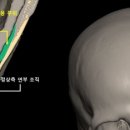 이지메이드
