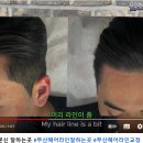 모델헤어라인 이미지