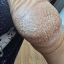 쇟보다 뒷꿈치 각질 심한분 계시오?(혐오사진주의) 이미지