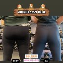 레이 피티 이미지