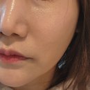 서면쥬베룩 서면 피부과 30대 쥬베룩스킨부스터 후기
