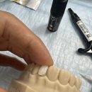 최소침습치료(minimally invasive dentistry) 세미나 후기 - 메릴랜드 브릿지 등