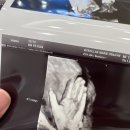 365웰스팜약국 | 임신 26주/별내마리산부인과/임당검사에서 임당확정까지