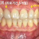 이프라임치과기공소 이미지