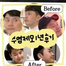 입술플러스7 | 남성 수염제모 1년치 후기/ 아포지엘리트플러스, 젠틀맥스프로 교차 시술/ 아가파의원 계양점
