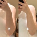 185 | 몰디브태닝 다산점 | 남양주태닝 | 화이트태닝전후사진 | 솔직후기
