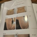 신대한엘피지제1 | 한남동바디관리) 엘피지오한남 바디조각술 후기