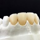 하이치과기공소 이미지