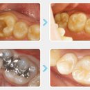 크리세라치과기공소 이미지