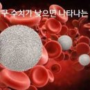 백혈구 수치가 낮으면 나타나는 증상 이미지