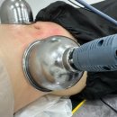 첨단중앙로152번길1 | 광주 첨단피부관리 수아르뷰티 더조각테라피 복부관리 후기