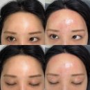뷰티바이윤 - 북구 | 광주 임산부왁싱 뷰티바이윤 헤어라인 이마 눈썹 왁싱 후기