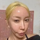 에스이에스 | SES 슈 피부과 시술 후기…12시간 만에 이렇게 변했다고?