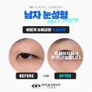 아이큐성형외과의원 이미지