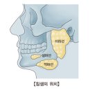 침샘염(Sialoadenitis) 이미지