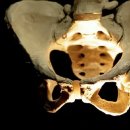 &#34;걷지도 못하겠네&#34;…나이를 불문하고 찾아오는 &#39;고관절 질환&#39; [명의] 이미지