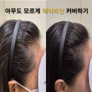 헤어라인 이미지