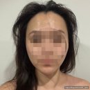 29170-2-B-01 | 강남에스테틱맛집 에스테틱공간2호점 리프팅+페이스마사지 후기