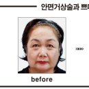 리즈 카카오 검색결과