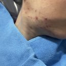 온한의원 | 목동 가양 한의원에서 여드름 박살내고 온 내돈내산 후기