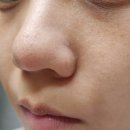 비비셀 - 중구 중구로24번길 22 | 비비셀 딥 클렌징 사용해 본 솔직 후기. (전, 후 비교)