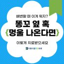 시흥드림항유외과 | 시흥항문외과 배변 시 똥꼬 옆 딱딱한 멍울, 혹은 이렇게