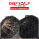 오직 스칼프 이미지