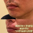 우리뷰티 - 북구 | 검단왁싱추천 보여줄게 완전히 달라진나~남편페이스왁싱후기 우리왁싱&뷰티 검단점