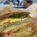 하니멍's(하니멍쓰) | 허벅지 지방추출주사 생생후기(멍, 붓기, 부작용)