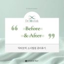 GS25평택소사벌점 | [공지] 평택탈모 평택두피 닥터모락 소사벌점 두피 건선 6개월 관리 후기