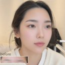 뷰티앤라인