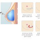 이시경유의원 | 서울 맘모톰 잘하는곳◐