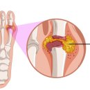 치유의 바람 이미지