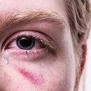 눈이안경원 이미지