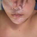 서초대로33길 4 | 내방피부관리 초이뷰티 고주파 리프팅 후기, 피부 윤곽이 달라지다