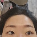 희헤어라인 이미지
